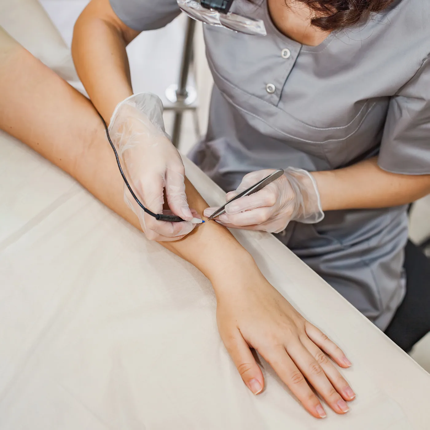 Electrolysis treatment on an arm in a clean studio