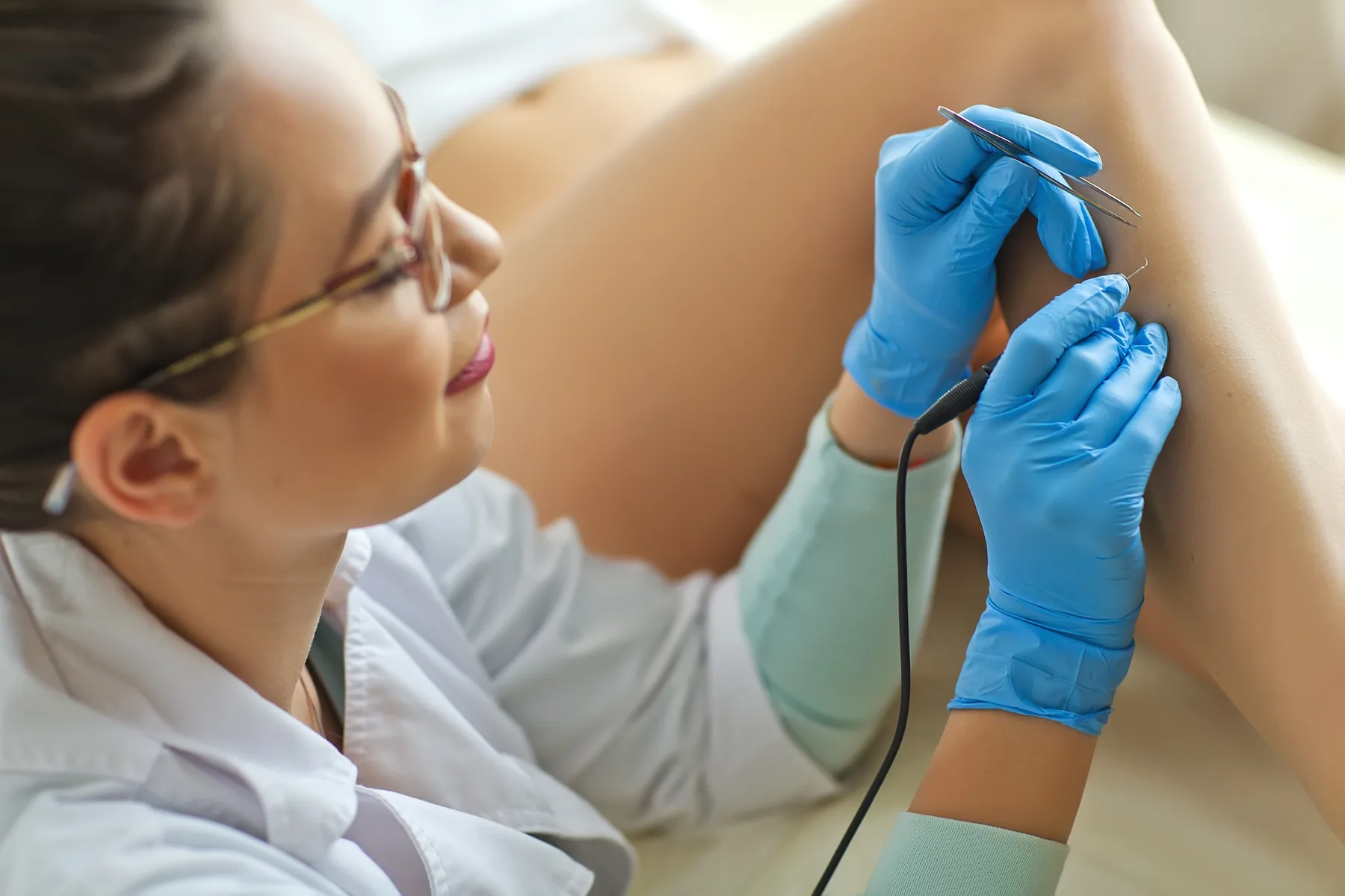 Gloved hands performing precise electrolysis treatment